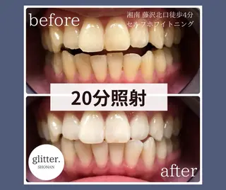 マツエク・マツパ ホワイトニング専門店 glitterのその他イメージ