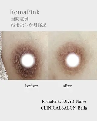 たるみほうれい線ケア 看護師サロンのエステ・リラクイメージ