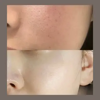 愛維美水光美肌専門店 メンズレディースokのエステ・リラクイメージ