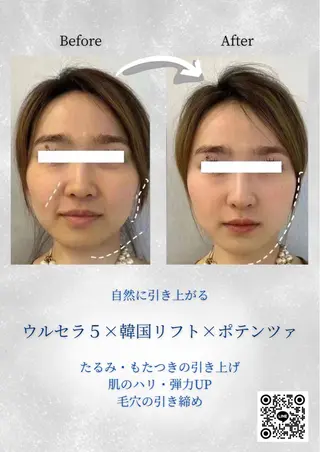 マツエク・マツパ 愛維美水光専門店 川崎彩鳳のエステ・リラクイメージ