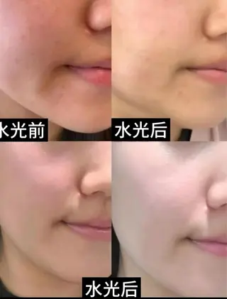 マツエク・マツパ 愛維美水光専門店 川崎彩鳳のエステ・リラクイメージ
