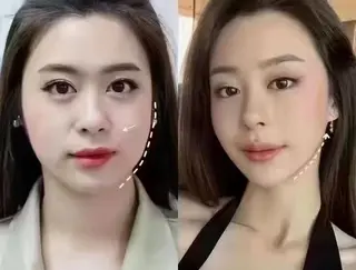 ネイル 愛維美水光専門店 川崎彩鳳のエステ・リラクイメージ