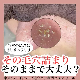 毛穴特化エステ -リールのエステ・リラクイメージ