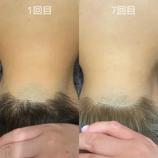 DUPE&MORE 店長kanaeのエステ・リラクイメージ