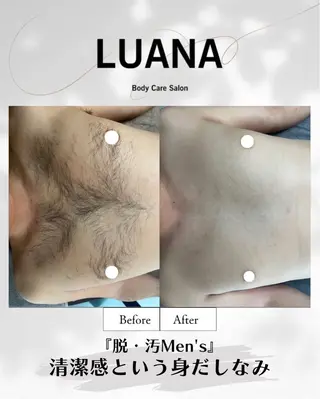 メンズ LUANA/小顔整体 /美容鍼/脱毛のエステ・リラクイメージ