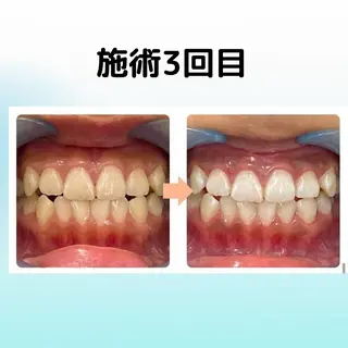 ホワイトニング シャトンのその他イメージ