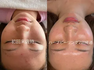 LUVRE龍田 MIKIまつ毛/眉毛のマツエク・マツパデザイン