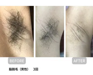 美肌・脱毛・痩身 サクラチャンスパのエステ・リラクイメージ