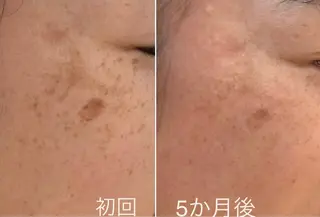 シミケア E Lashのエステ・リラクイメージ