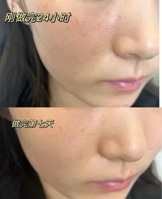 ショート 愛維美水光専門店 川崎彩鳳のエステ・リラクイメージ