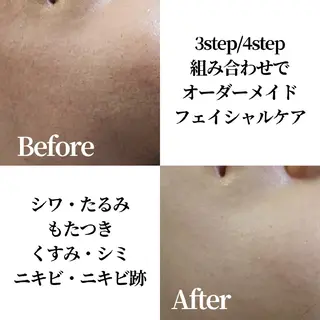 CHOOSE/島田 根本改善/代々木上原のエステ・リラクイメージ