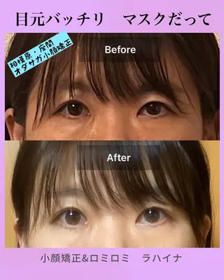 小顔矯正 ラハイナのエステ・リラクイメージ