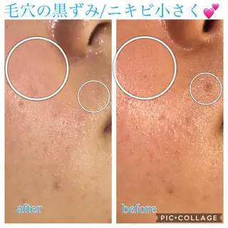 ロング カラー パーマ ヘアアレンジ キッズ ネイル マツエク・マツパ EnsorClair 代表 野口真央のエステ・リラクイメージ