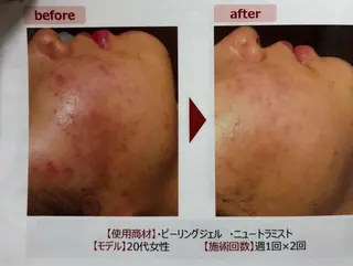 トータルサロン Re`ZAltの眉毛・アイブロウイメージ