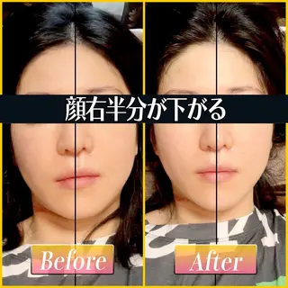歪み専門🌟筋膜整体 てんてん 畠山のエステ・リラクイメージ