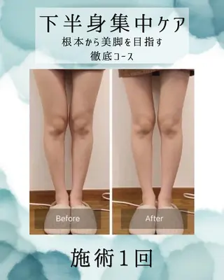 医療提携 肌管理痩身エステ池袋のエステ・リラクイメージ