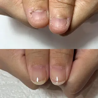 ネイル 自爪育成・巻き爪 補正講師 津蔵のネイルデザイン