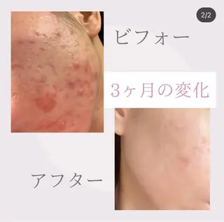🎀BiBi韓国美容 コスパ強!美活サロンのエステ・リラクイメージ