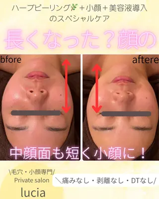lucia  豊明 肌管理のエステ・リラクイメージ