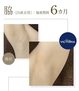 Butterfly 平塚店　佐藤のエステ・リラクイメージ