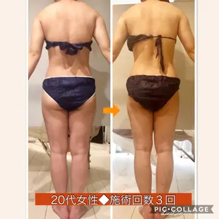 ロング カラー パーマ ヘアアレンジ メンズ キッズ ネイル マツエク・マツパ ‍痩身＆ボディ 結果出し🌟丹野のエステ・リラクイメージ