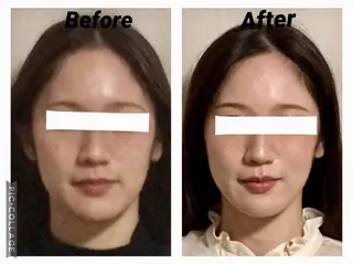 小顔矯正Sho  FaceDesignのエステ・リラクイメージ