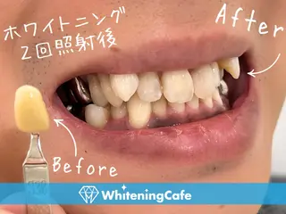 ホワイトニングカフェ 徳島沖浜店のその他イメージ