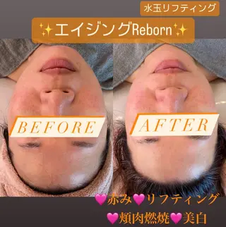 Tipani beaute'のエステ・リラクイメージ