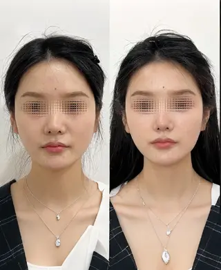 愛維美水光専門店 川崎彩鳳のエステ・リラクイメージ