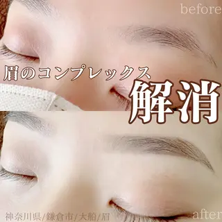アイブロウ ハーブピーリング /KAEDEのエステ・リラクイメージ