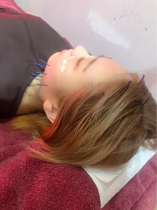 美容鍼灸女性専用 りんご鍼灸治療院のエステ・リラクイメージ