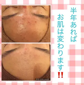 ミディアム カラー パーマ ヘアアレンジ メンズ キッズ ネイル マツエク・マツパ ニキビ・肌質改善専門 ♡人生が変わるサロンのエステ・リラクイメージ
