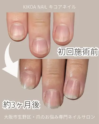 ネイル KIKOA NAIL キコアネイルのネイルデザイン