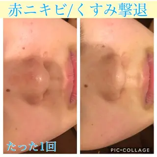 ショート カラー パーマ ヘアアレンジ キッズ ネイル マツエク・マツパ EnsorClair 代表 野口真央のエステ・リラクイメージ