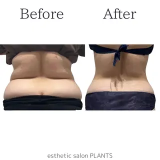 エステティックサロン PLANTSのエステ・リラクイメージ