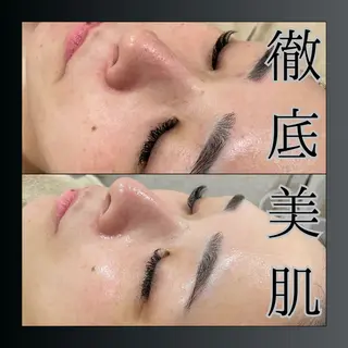 LiZA エステティックサロンのエステ・リラクイメージ