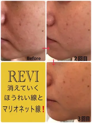 美肌❤️美眉 結果重視サロン✨のエステ・リラクイメージ