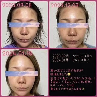 LiZA エステティックサロンのエステ・リラクイメージ