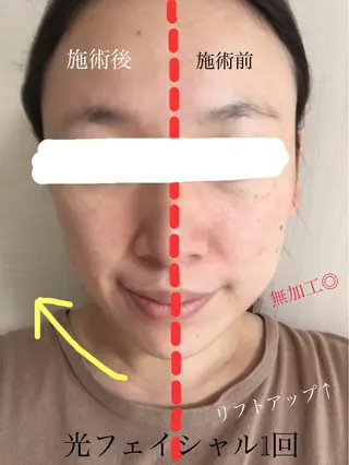 シマダ ユキコのネイルデザイン