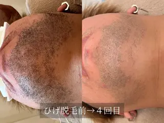 脱毛サロン Arumのエステ・リラクイメージ