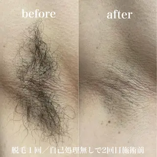 磐田|LAYLA 一番丁寧な脱毛店のエステ・リラクイメージ