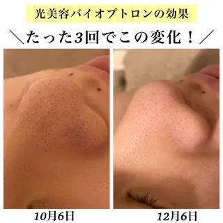 Bellesthe (ベルエステ)のエステ・リラクイメージ