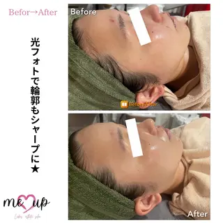 Meupニキビ専門店 背中/ハーブ/肌管理のその他イメージ