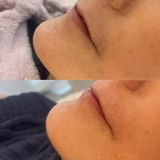 マツエク&顔Wax Salonフルリールのマツエク・マツパデザイン