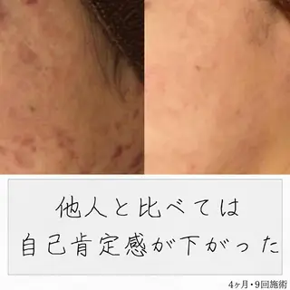 ニキビ経験者が施術 する専門サロン🌻のエステ・リラクイメージ