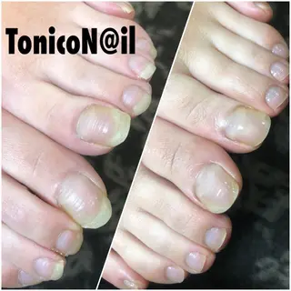 ネイル TonicoN@il トニコネイルのネイルデザイン