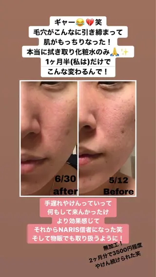 シマダ ユキコのネイルデザイン