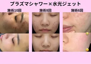 愛維美水光美肌専門店 メンズレディースokのエステ・リラクイメージ