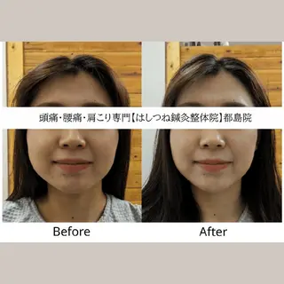 頭痛・腰痛・肩こり 特化してます。 橋岡のエステ・リラクイメージ