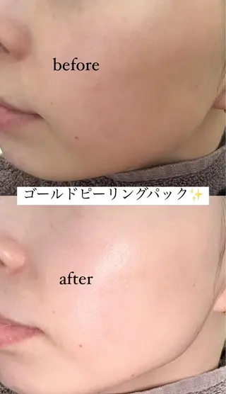肌質改善サロン réposのその他イメージ